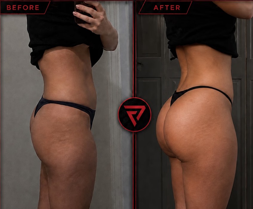 Amanda B before and after — Base Plan, 12+ weeks